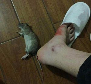 Bị chuột cắn chảy máu có sao không, có nguy hiểm không?